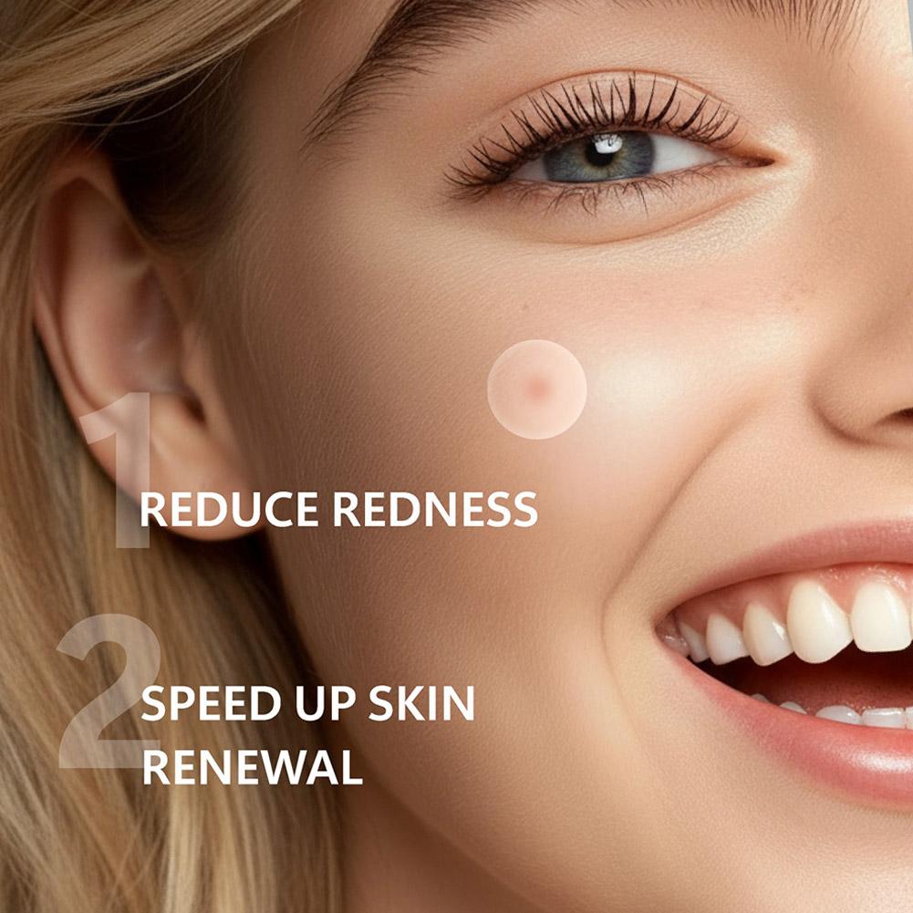 Invisible Micro Needle Acne Pa - огляд і ціна Skincare You