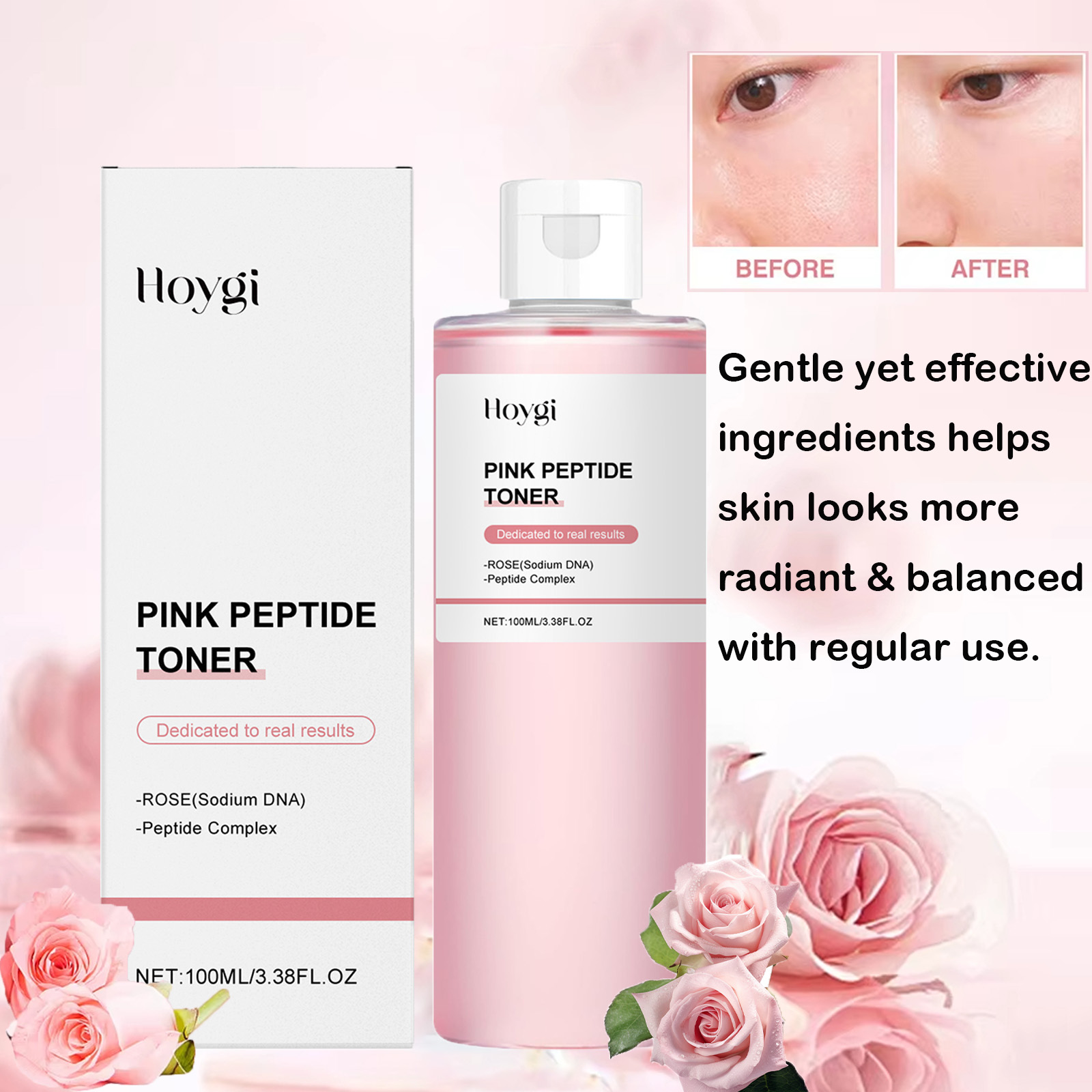 Rose Essence Toner Glowing Ski - огляд і ціна Centella Asiatica Toner
